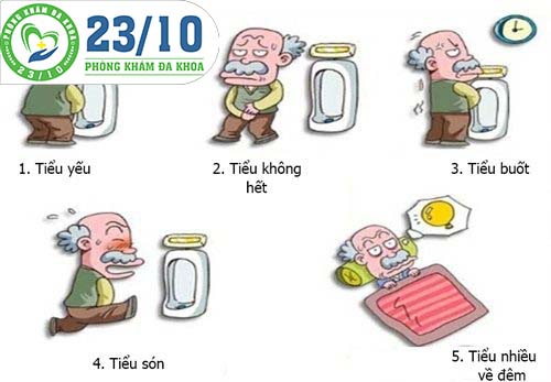Một số triệu chứng của u xơ tuyến tiền liệt