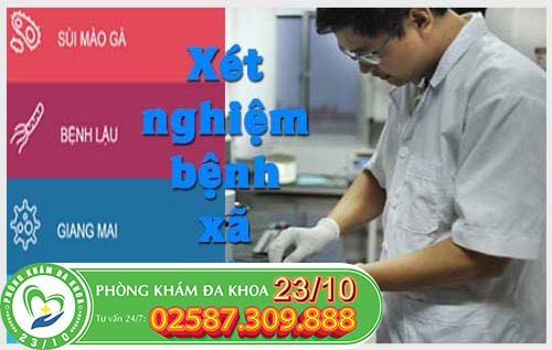 Cách xét nghiệm bệnh hoa liễu là gì?