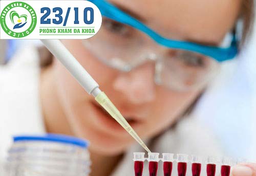 Phương pháp xét nghiệm lậu