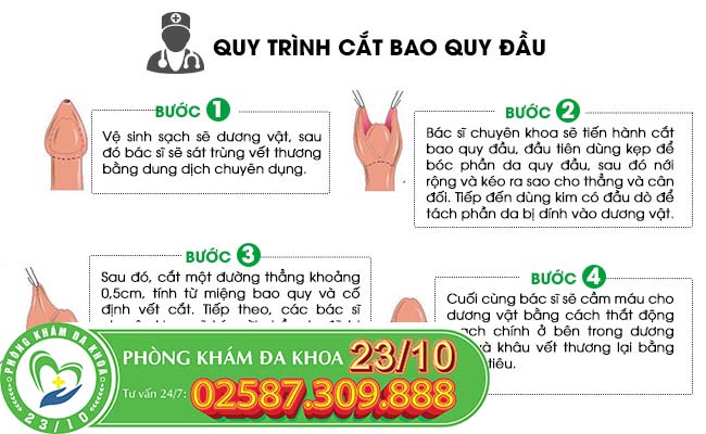 Quy trình cắt bao quy đầu bằng phương pháp xâm lấn tối thiểu Quy trình cắt bao quy đầu bằng phương pháp xâm lấn tối thiểu