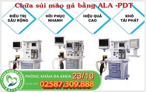 Ưu điểm phương pháp ALA-PDT trong việc hỗ trợ điều trị sùi mào gà